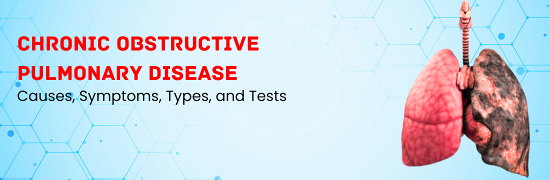 Chronic Obstructive Pulmonary Disease (COPD): Causes, Symptoms, Types, and Tests